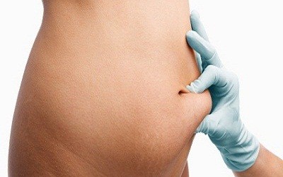 Tummy Tuck Surgeon in Kolkata