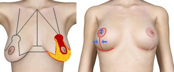 Best Plastic Surgeon in Manipal Hospital