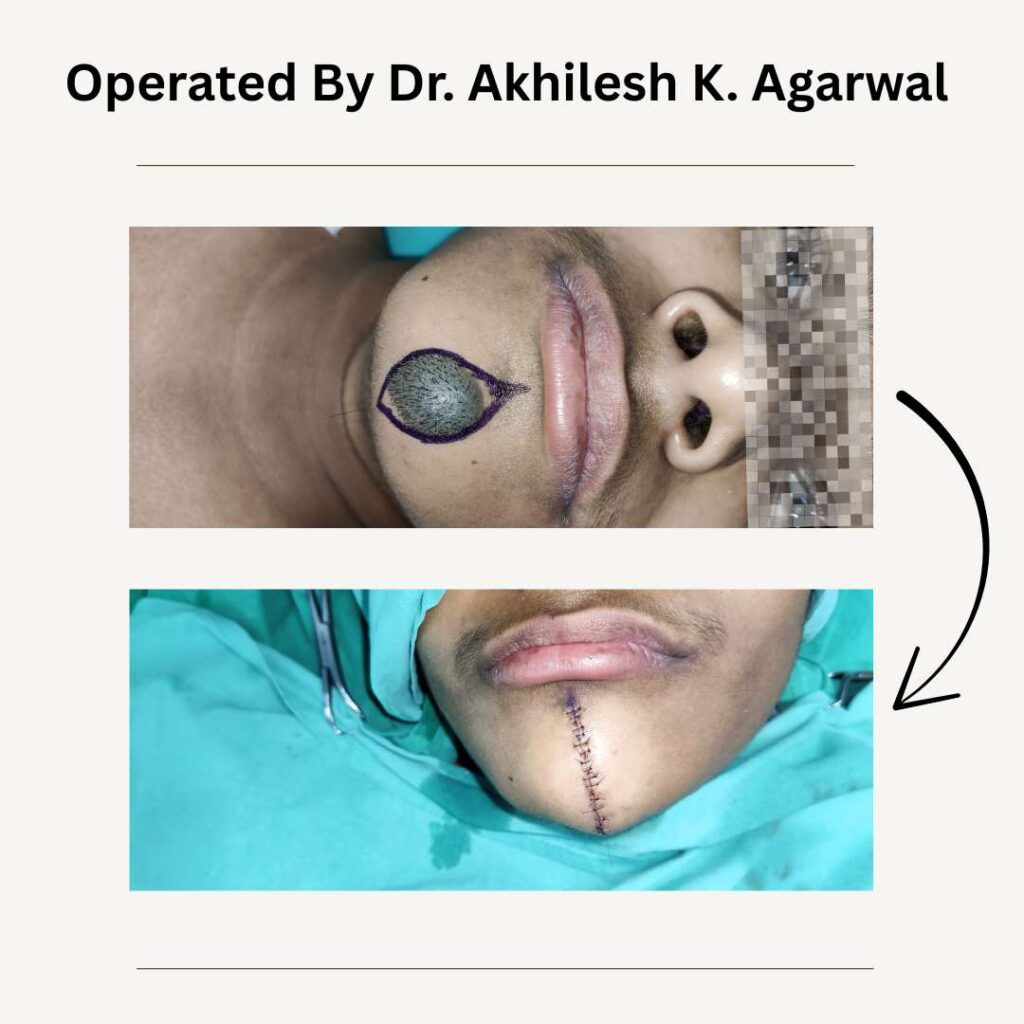 Best Cosmetic Surgeon in Kolkata