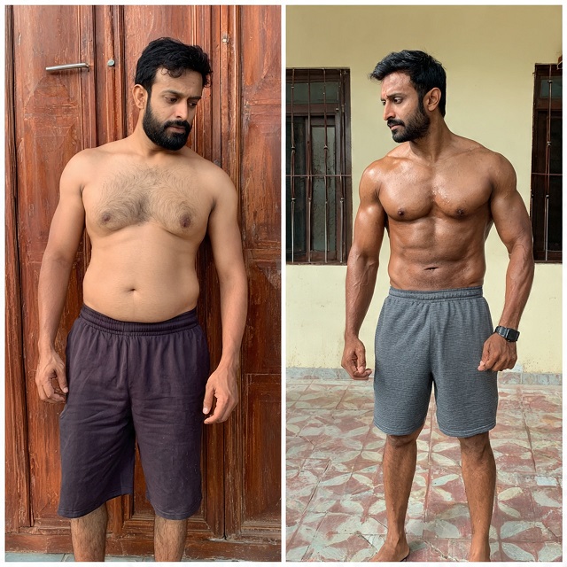 Fat Loss Surgery male